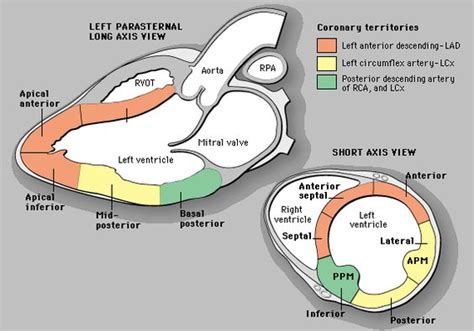 mild hypokinesis of the basal inferior wall.